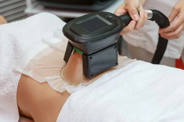 Image of person having fat freezing treatment to help weight gain Whitnash