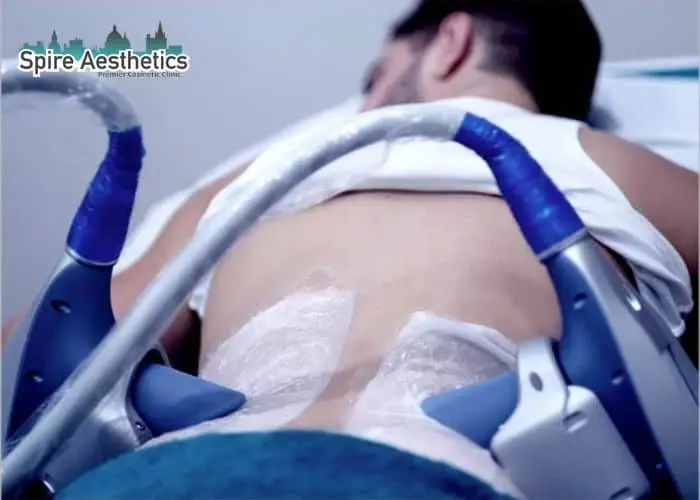 Man having fat freezing treatment done on love handles before a competitions Whitnash to create a sculpted look.