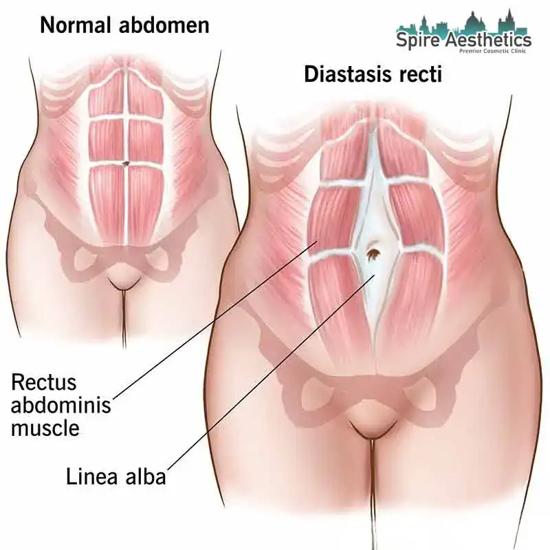 When Will My Belly Feel Normal Again Whitnash?